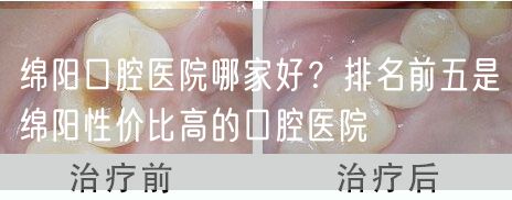 绵阳口腔医院哪家好？排名前五是绵阳性价比高的口腔医院
