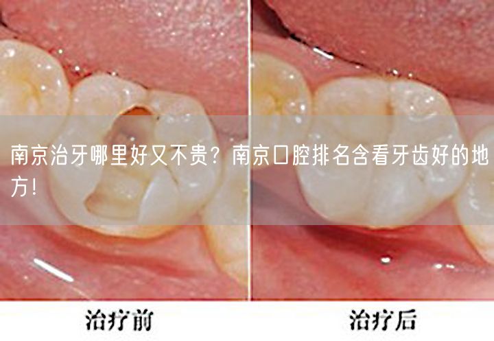 南京治牙哪里好又不贵？南京口腔排名含看牙齿好的地方！