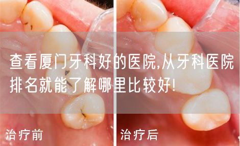 查看厦门牙科好的医院,从牙科医院排名就能了解哪里比较好!