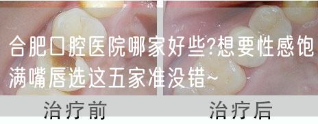 合肥口腔医院哪家好些?想要性感饱满嘴唇选这五家准没错~
