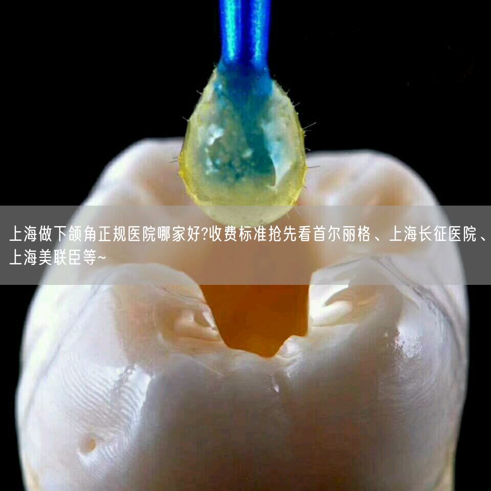 上海做下颌角正规医院哪家好?收费标准抢先看首尔丽格、上海长征医院、上海美联臣等~