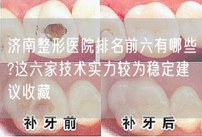 济南整形医院排名前六有哪些?这六家技术实力较为稳定建议收藏
