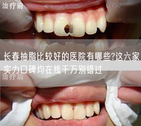 长春抽脂比较好的医院有哪些?这六家实力口碑均在线千万别错过