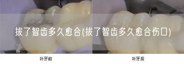 拔了智齿多久愈合(拔了智齿多久愈合伤口)