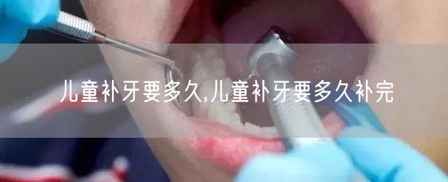 儿童补牙要多久,儿童补牙要多久补完