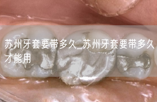 苏州牙套要带多久_苏州牙套要带多久才能用(图1)