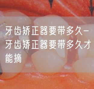牙齿矫正器要带多久-牙齿矫正器要带多久才能摘