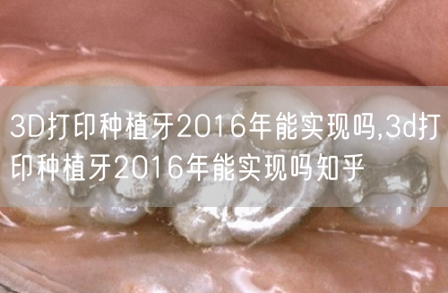 3D打印种植牙2016年能实现吗,3d打印种植牙2016年能实现吗知乎