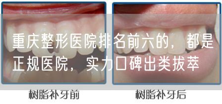 重庆整形医院排名前六的，都是正规医院，实力口碑出类拔萃