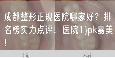 成都整形正规医院哪家好？排名榜实力点评！医院1}pk嘉美！