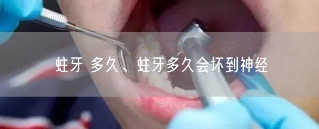 蛀牙 多久、蛀牙多久会坏到神经(图1)