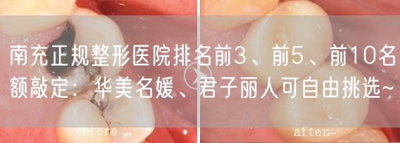 南充正规整形医院排名前3、前5、前10名额敲定：华美名媛、君子丽人可自由挑选~