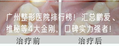 广州整形医院排行榜！汇总鹏爱、维秘等4大金刚，口碑实力强者！