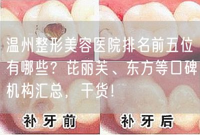 温州整形美容医院排名前五位有哪些？芘丽芙、东方等口碑机构汇总，干货！