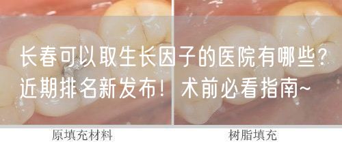 长春可以取生长因子的医院有哪些？近期排名新发布！术前必看指南~