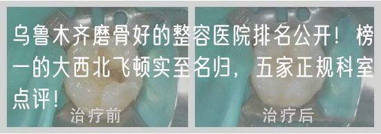 乌鲁木齐磨骨好的整容医院排名公开！榜一的大西北飞顿实至名归，五家正规科室点评！