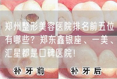 郑州整形美容医院排名前五位有哪些？郑东鑫银座、一美、汇星都是口碑医院！