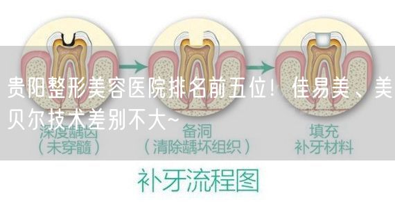 贵阳整形美容医院排名前五位！佳易美、美贝尔技术差别不大~