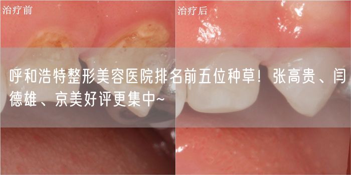 呼和浩特整形美容医院排名前五位种草！张高贵、闫德雄、京美好评更集中~