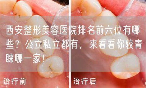 西安整形美容医院排名前六位有哪些？公立私立都有，来看看你较青睐哪一家！