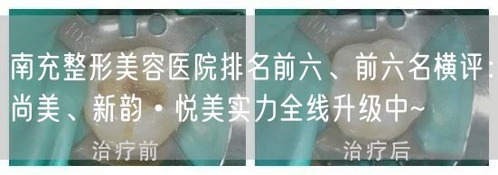 南充整形美容医院排名前六、前六名横评：尚美、新韵•悦美实力全线升级中~