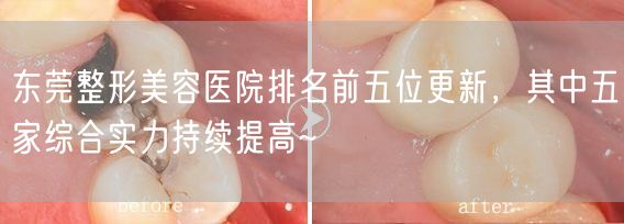 东莞整形美容医院排名前五位更新，其中五家综合实力持续提高~