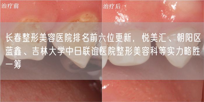 长春整形美容医院排名前六位更新，悦美汇、朝阳区蓝鑫、吉林大学中日联谊医院整形美容科等实力略胜一筹