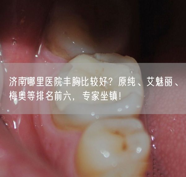 济南哪里医院丰胸比较好？原纯、艾魅丽、梅奥等排名前六，专家坐镇！