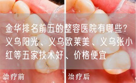 金华排名前五的整容医院有哪些？义乌阳光、义乌欧莱美、义乌张小红等五家技术好、价格便宜