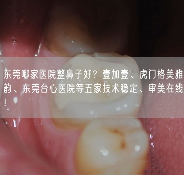 东莞哪家医院整鼻子好？壹加壹、虎门格美雅韵、东莞台心医院等五家技术稳定、审美在线！