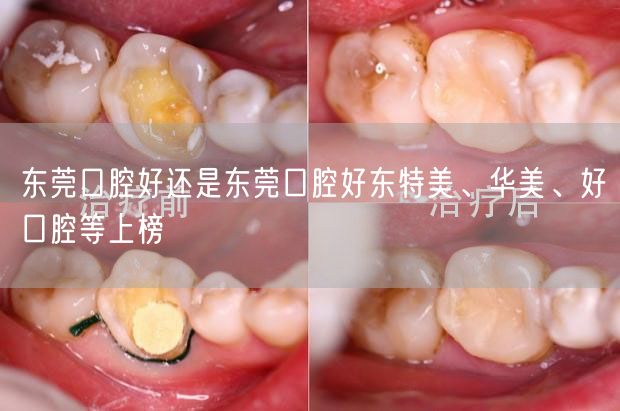 东莞口腔好还是东莞口腔好东特美、华美、好口腔等上榜
