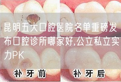 昆明五大口腔医院名单重磅发布口腔诊所哪家好,公立私立实力PK