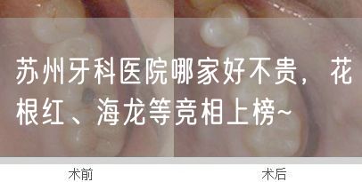 苏州牙科医院哪家好不贵，花根红、海龙等竞相上榜~