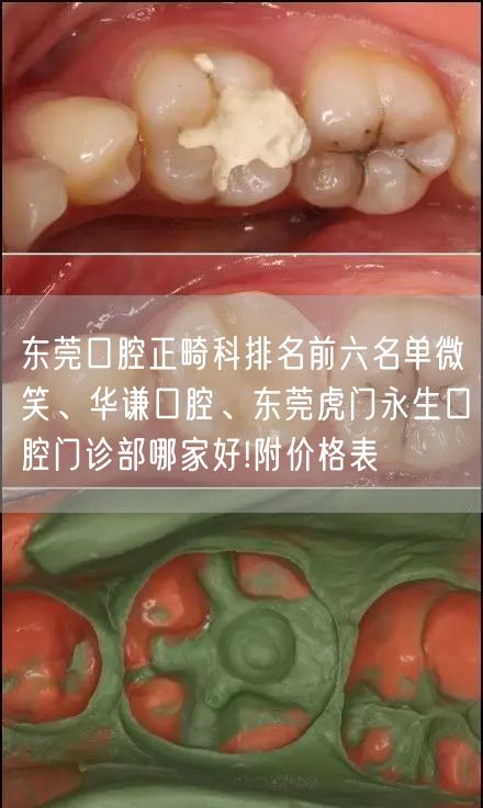 东莞口腔正畸科排名前六名单微笑、华谦口腔、东莞虎门永生口腔门诊部哪家好!附价格表
