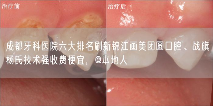 成都牙科医院六大排名刷新锦江画美团圆口腔、战旗杨氏技术强收费便宜，@本地人