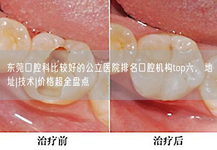 东莞口腔科比较好的公立医院排名口腔机构top六，地址|技术|价格超全盘点