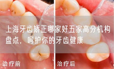 上海牙齿矫正哪家好五家高分机构盘点，呵护你的牙齿健康