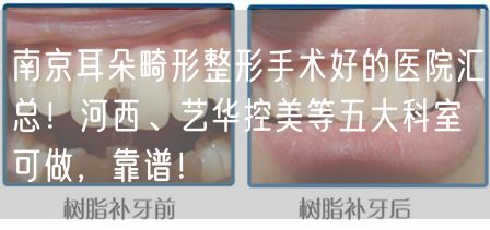 南京耳朵畸形整形手术好的医院汇总！河西、艺华控美等五大科室可做，靠谱！