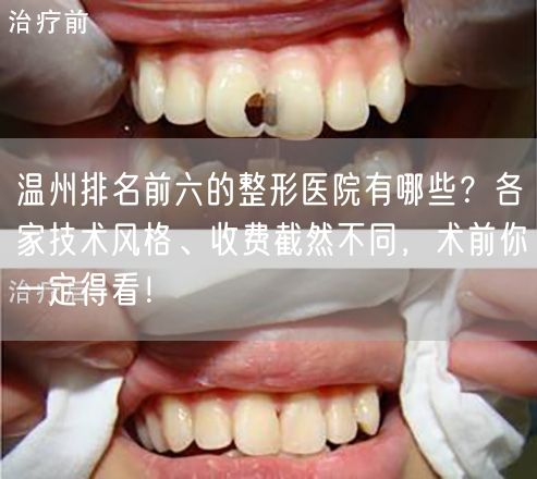 温州排名前六的整形医院有哪些？各家技术风格、收费截然不同，术前你一定得看！