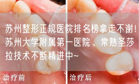 苏州整形正规医院排名榜拿走不谢！苏州大学附属第一医院、常熟圣莎拉技术不断精进中~