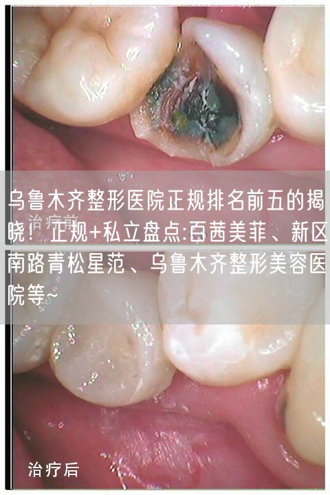 乌鲁木齐整形医院正规排名前五的揭晓！正规+私立盘点:百茜美菲、新区南路青松星范、乌鲁木齐整形美容医院等~