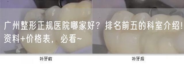 广州整形正规医院哪家好？排名前五的科室介绍！资料+价格表，必看~