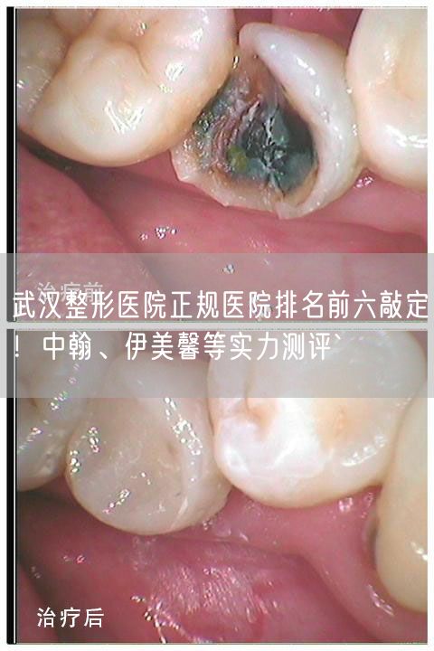 武汉整形医院正规医院排名前六敲定！中翰、伊美馨等实力测评`