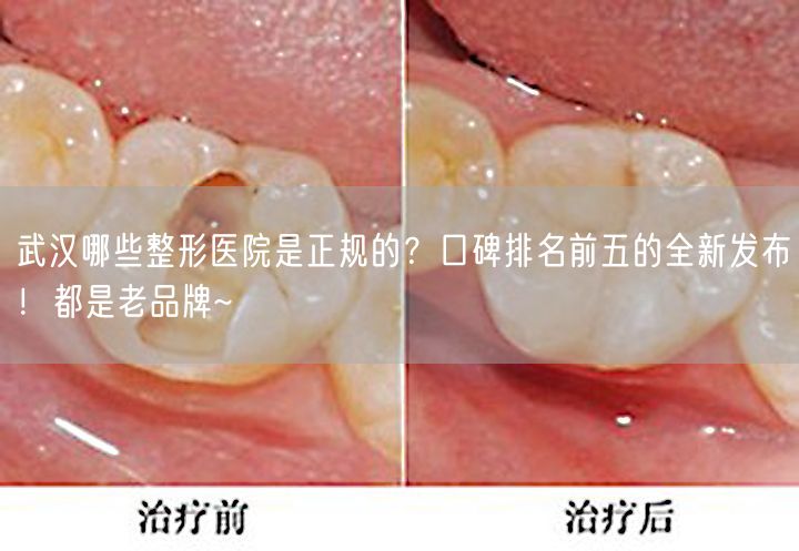 武汉哪些整形医院是正规的？口碑排名前五的全新发布！都是老品牌~
