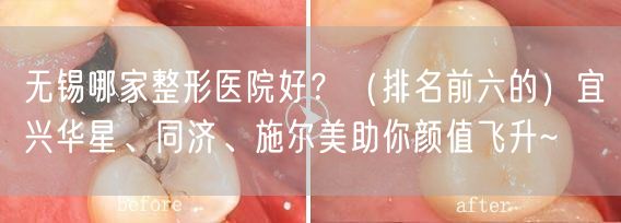 无锡哪家整形医院好？（排名前六的）宜兴华星、同济、施尔美助你颜值飞升~