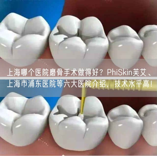 上海哪个医院磨骨手术做得好？PhiSkin芙艾、上海市浦东医院等六大医院介绍，技术水平高！