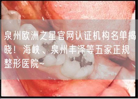 泉州欧洲之星官网认证机构名单揭晓！海峡、泉州丰泽等五家正规整形医院~