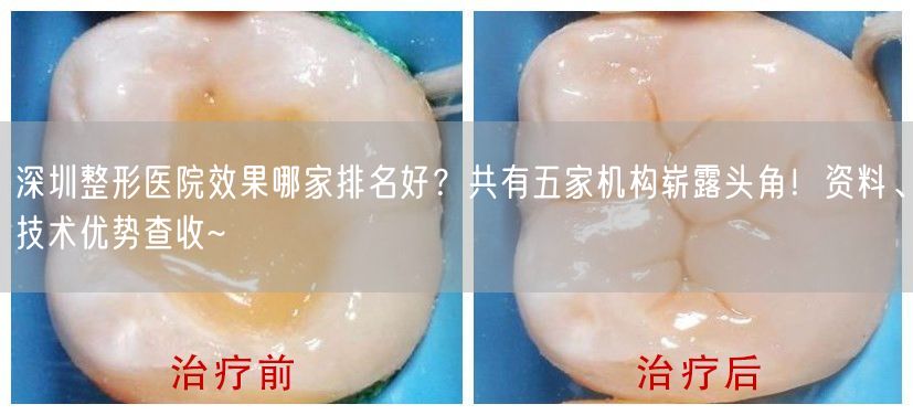 深圳整形医院效果哪家排名好？共有五家机构崭露头角！资料、技术优势查收~