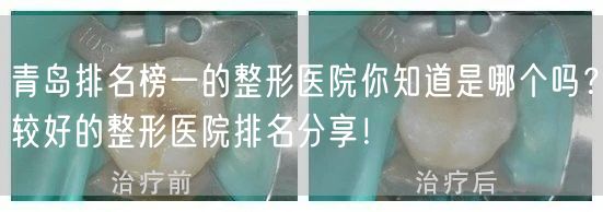 青岛排名榜一的整形医院你知道是哪个吗？较好的整形医院排名分享！