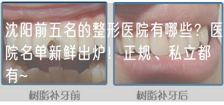 沈阳前五名的整形医院有哪些？医院名单新鲜出炉！正规、私立都有~